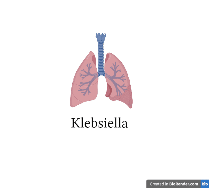 Klebsiella | microbiology notes